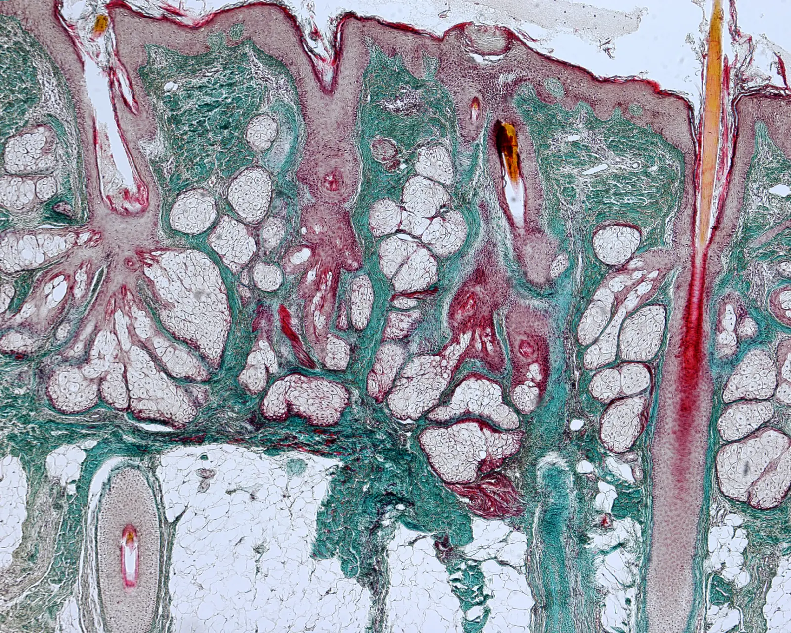 A stained histology section of skin showing layered tissue, follicles and connective structure